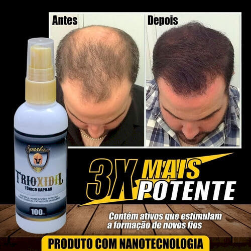 Trinoxidil tonico capilar - Produtos Premium (1)